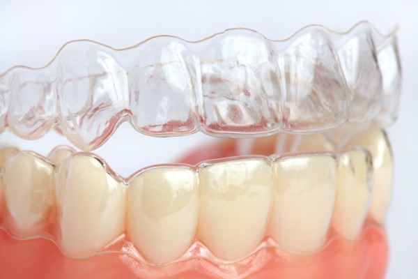 Clear Aligners or Invisible Braces: Everything You Need to Know About Clear  Braces 