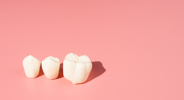 When Is Getting A Dental Crown Necessary?